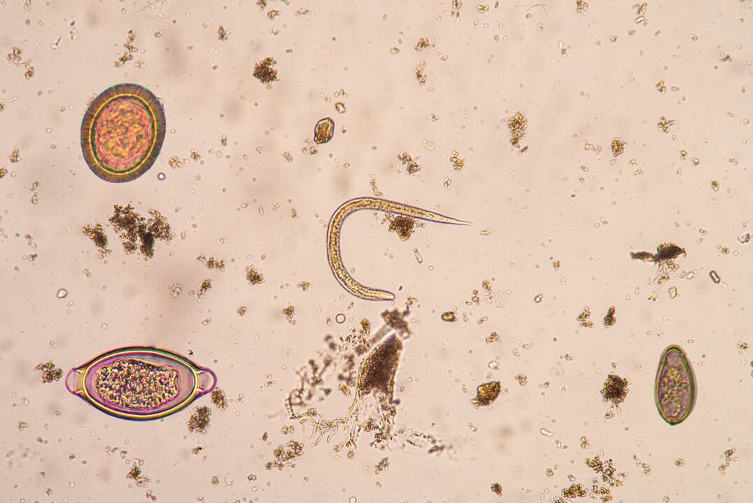 Larval stage ng subcutaneous parasites