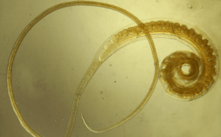 Human whipworm - isang helminth na nakakaapekto sa mga kabataan