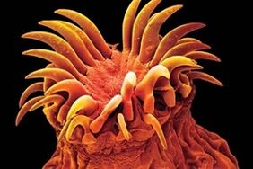 Trematode parasites sa mga tao