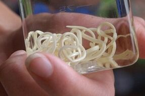 mga parasito mula sa katawan ng tao