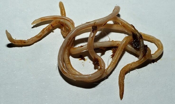 Toxocara mula sa katawan ng tao